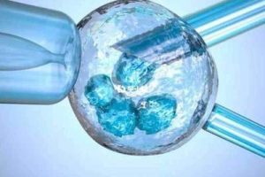 试管婴儿需要准备哪些材料?一文搞定