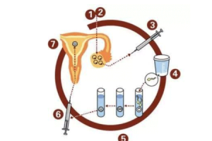 试管婴儿前需要进行哪些检查?检查项目多吗?