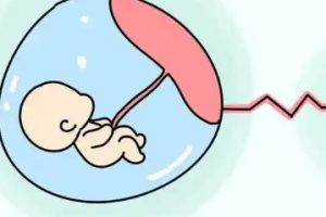 第三代试管婴儿:成功的关键因素与流程详解