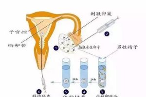试管婴儿全过程详解:从术前检查到怀孕检测,每一步都清晰明了