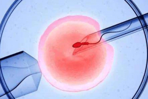 试管婴儿的整个流程需要多长时间?